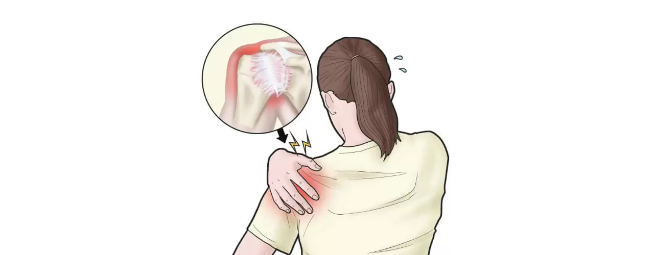 shoulder pain relief in King Physical Therapy