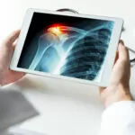 Doctor looking at shoulder xray